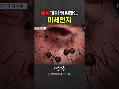 1급 발암물질! 미세먼지의 위험성