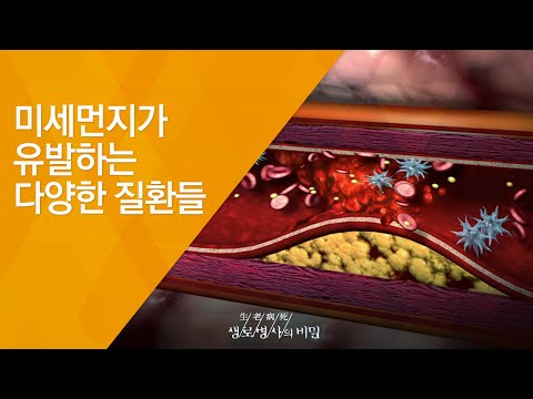 미세먼지가 유발하는 다양한 질환들 - (20150311_537회 방송)_보이지 않는 적, 미세먼지